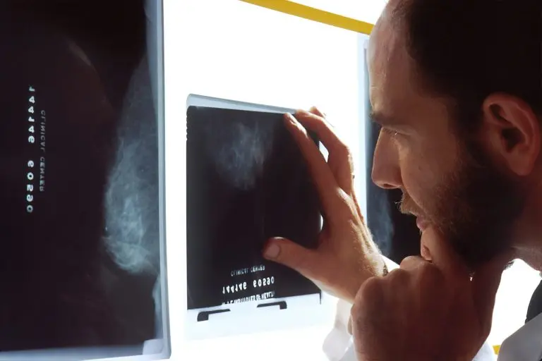 dokter memeriksa hasil rontgen - apa saja mitos kanker?