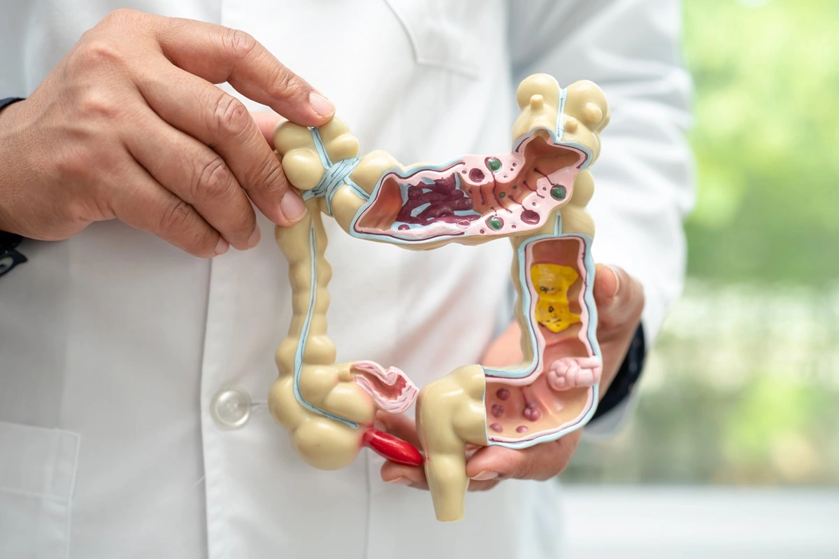 doctor holding anatomy model of colon