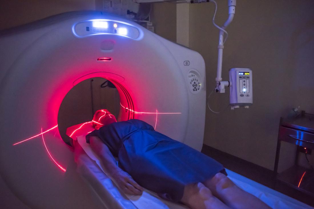PET Scan Radioactivity