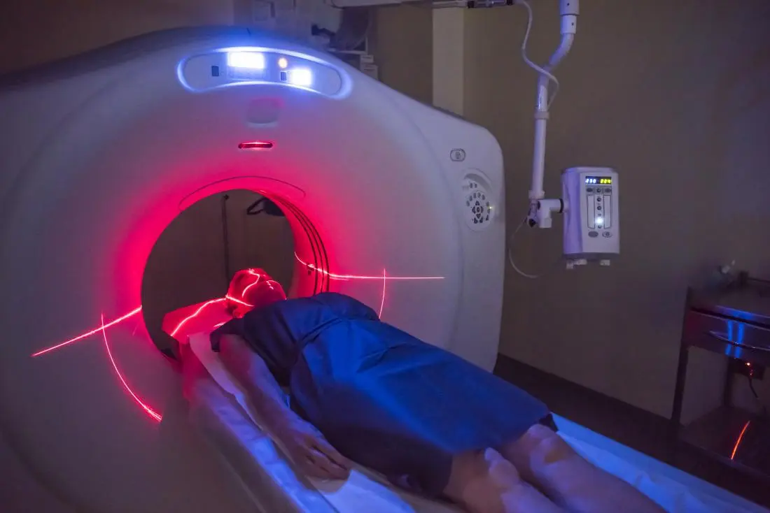 PET Scan Radioactivity