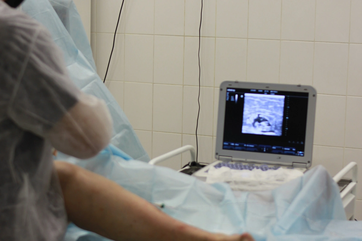 Mendeteksi kanker dini dengan USG