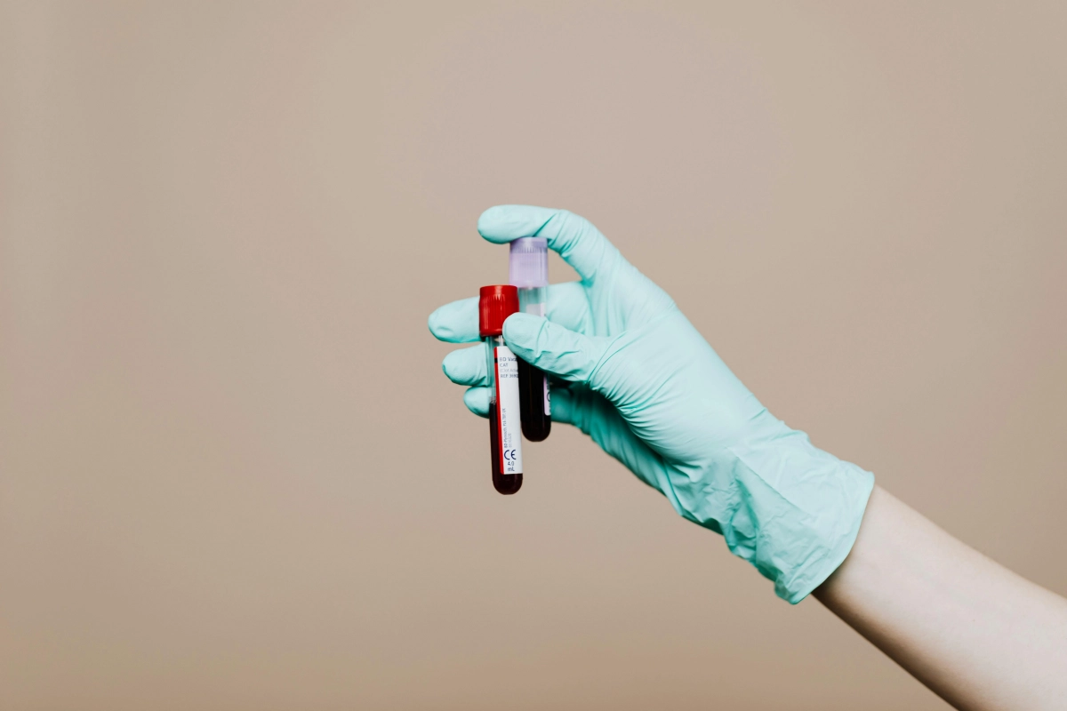 Benarkah Tes Darah Bisa Mendeteksi Kanker?