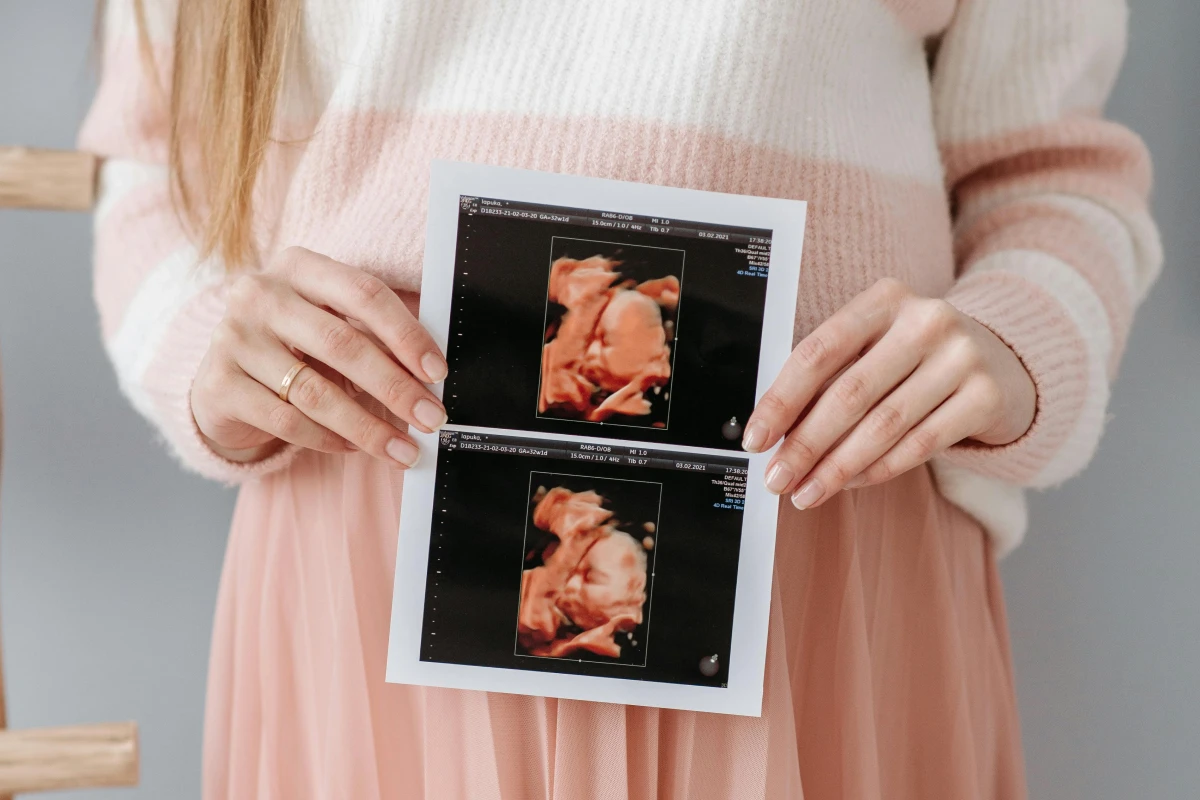 USG 4D tidak hanya untuk melihat wajah bayi secara nyata namun memiliki fungsi medis yang penting