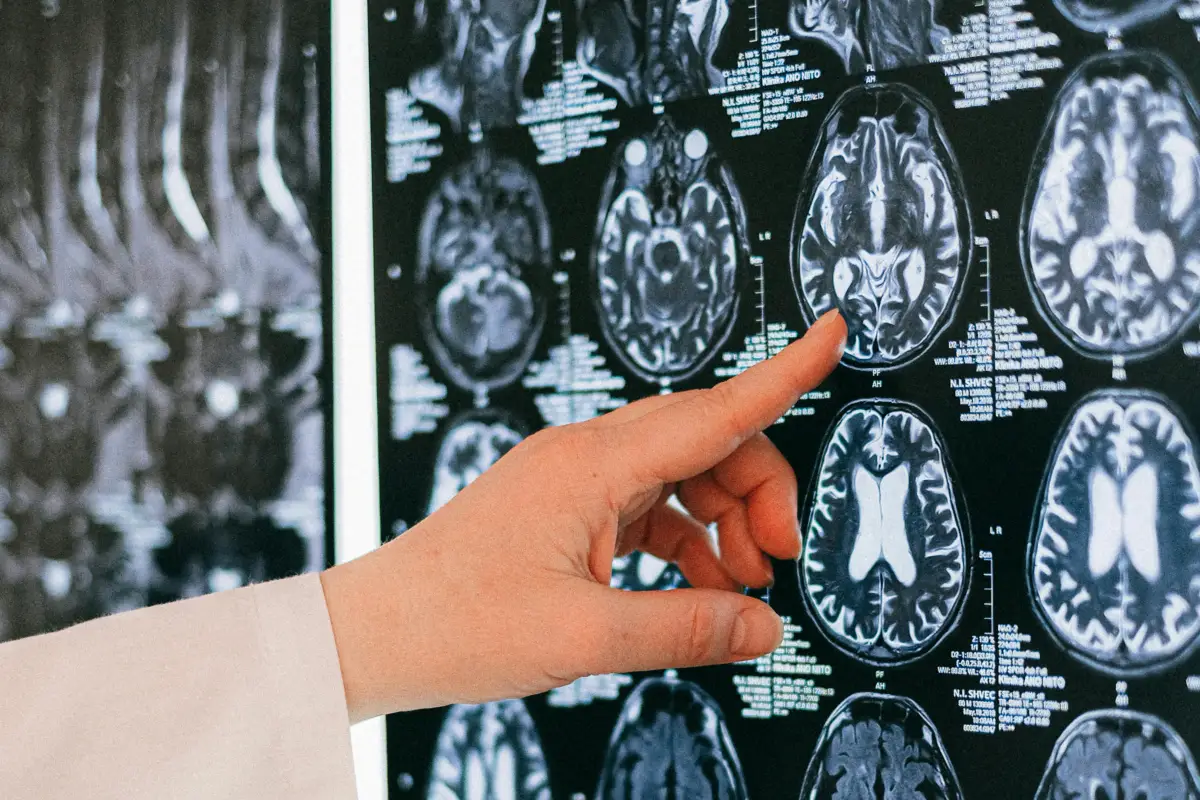 Dokter menganalisa hasil pindaian tumor pasien