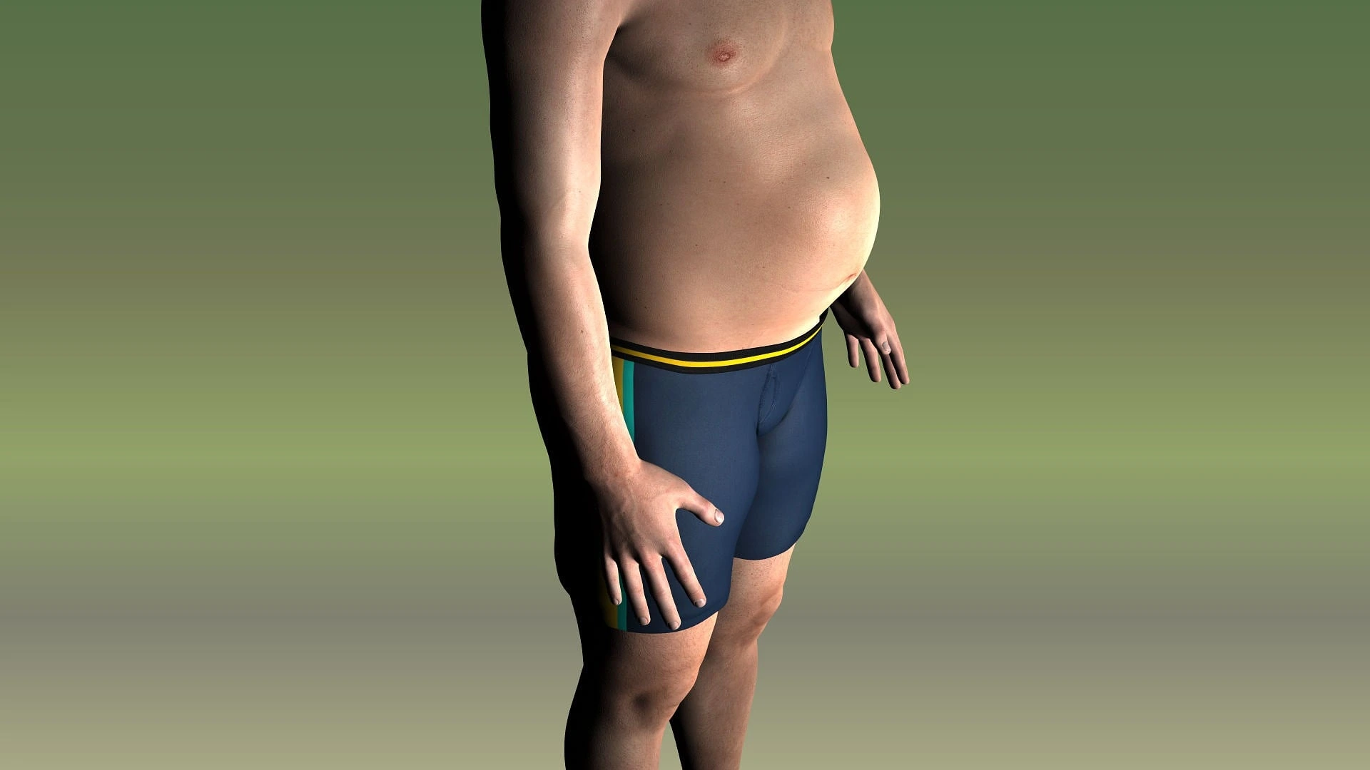 obesitas