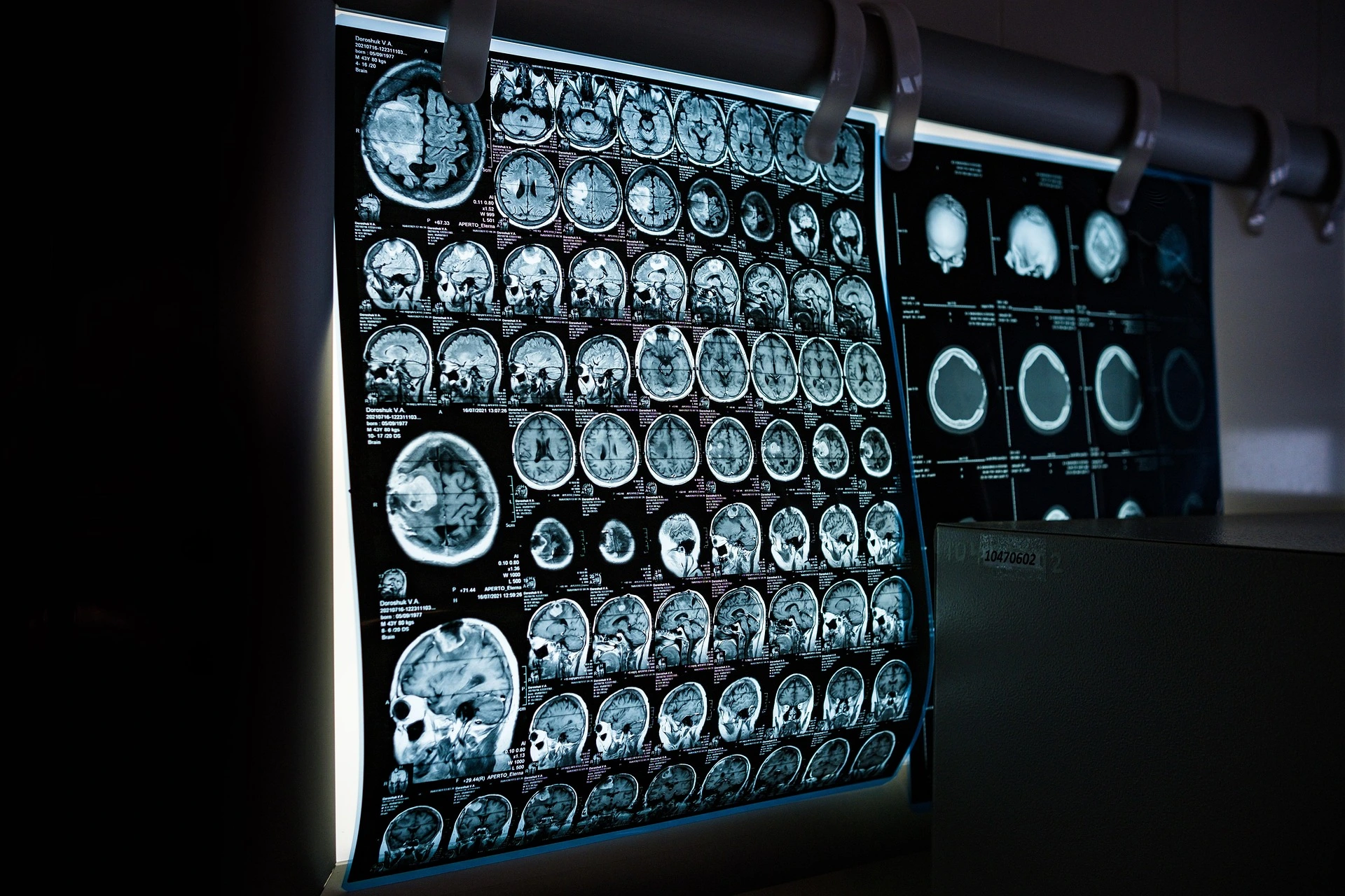 pet scan